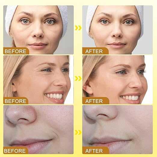 Bee Venom Wrinkle Cream Anti-Aging Face Cream